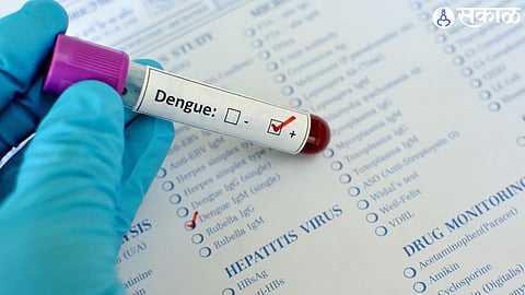 latur virology lab only on paper reports of dengue suspects are received after eight days