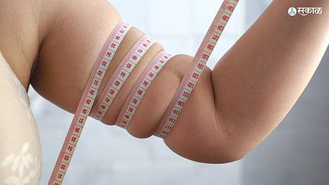 Arm Fat