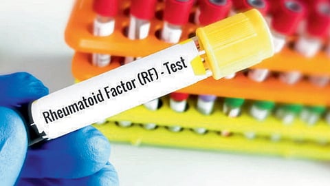 RF test