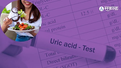 Home Remedies For Uric Acid: