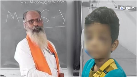  Karnataka Third-Grader Beaten with Burning Wood