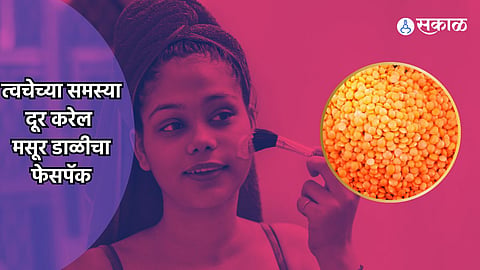 Masoor Dal Face Pack