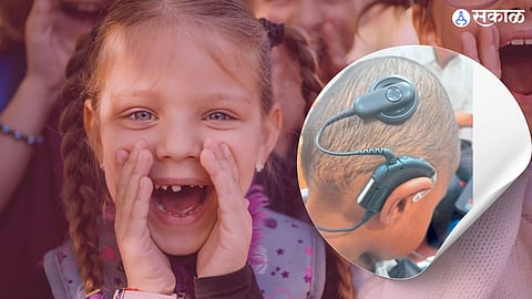 Cochlear Implant under ADIP scheme 144 child listen universe voice for first time nagpur
