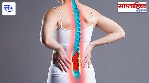 Osteoporosis