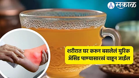 Uric Acid Remedies 