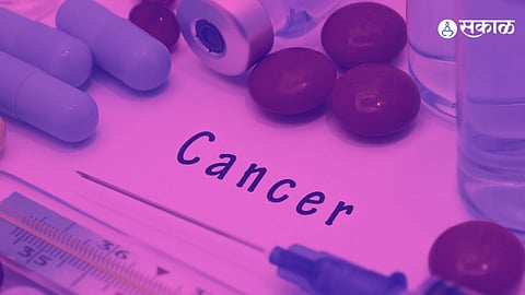 Women Cancer Treatment 