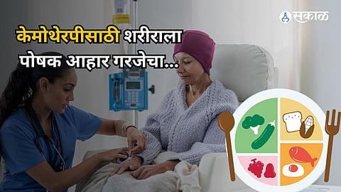 Chemotherapy