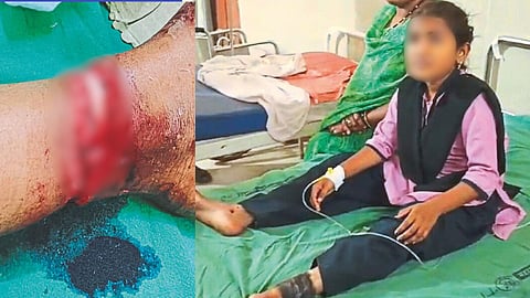 Nylon Manja Incident 