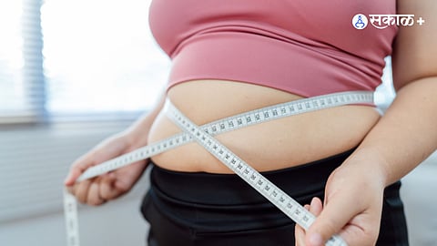 Obesity new guidelines