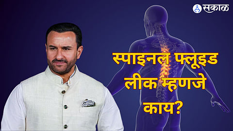 Saif Ali Khan spinal fluid leak 
