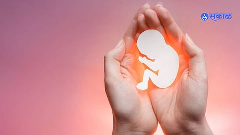 Illegal Abortion