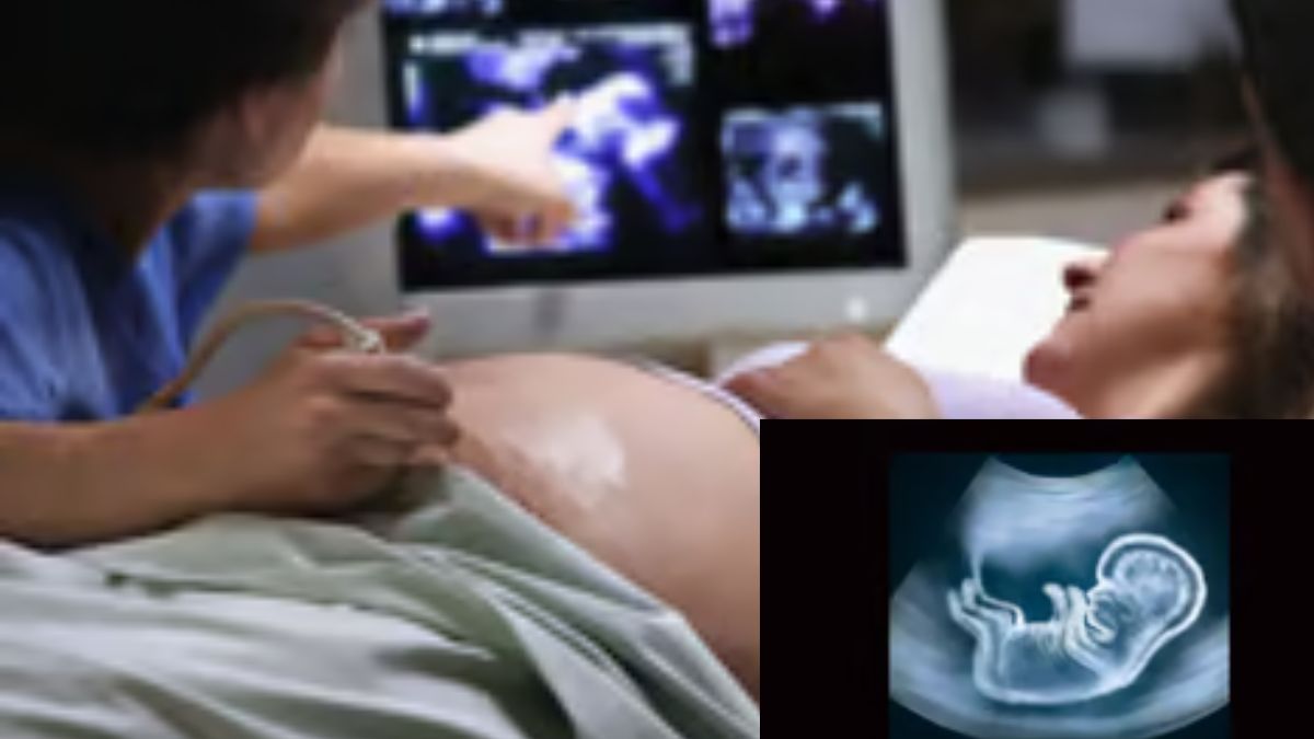 Pregnant Women