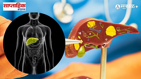 Liver Reconstruction 