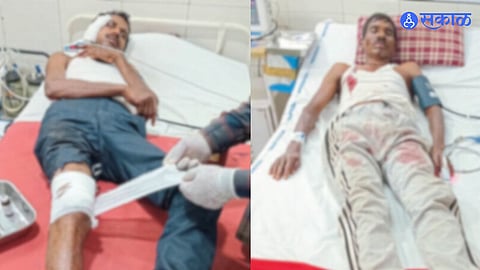 Two men injured in tiger attack near Girla village in Mohghata