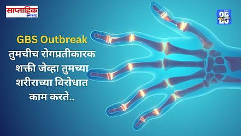 GBS outbreak