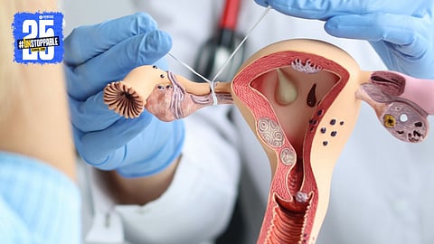 Sterilization Surgery 