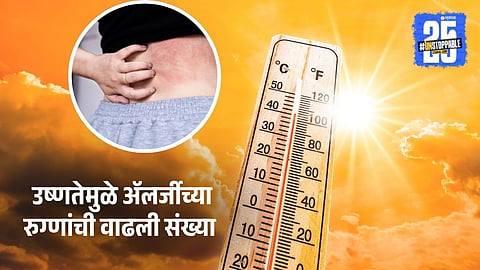 Rise In Allergy Cases Due To Heat