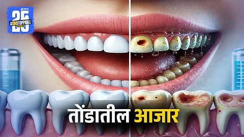 Mouth Disease