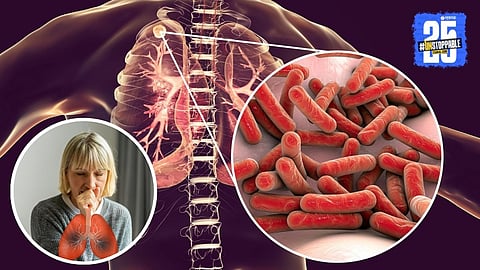 AI-Powered TB Diagnosis