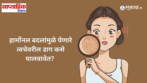 sensitive skin problem