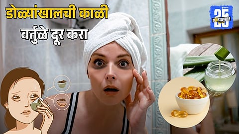Dark Circles Remedy