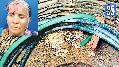 Injured but fearless: Woman from Renukanagar fights leopard to save her marital symbol.
