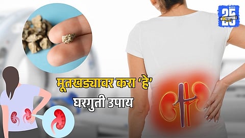 Kidney Stone 