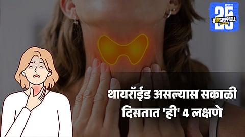 thyroid symptoms,