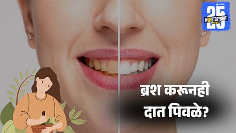 How to whiten yellow teeth naturally at home


