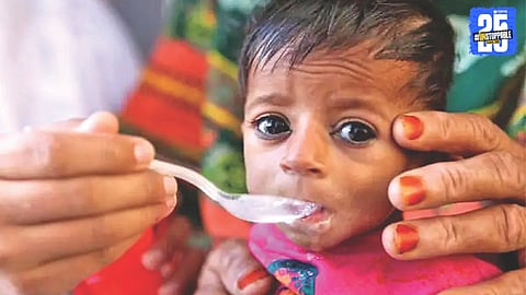  malnutrition