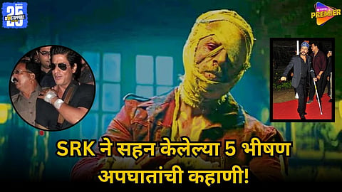 Shah Rukh Khan Suffers Another Injury During ‘King’ Shoot | Full Injury History: 