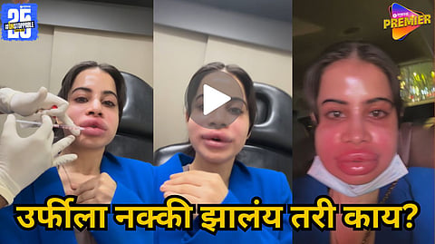 Urfi Javed lip filler removal full video Viral 
