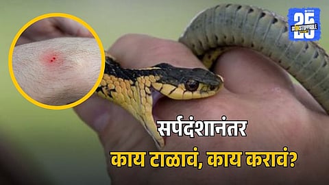 Signs and Symptoms of Snakebite