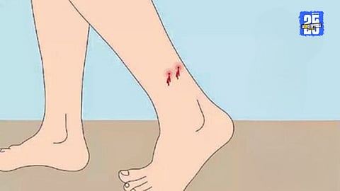 Snakebite Awareness