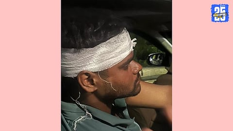 employee injured