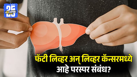 How Fatty Liver Leads to Liver Cancer