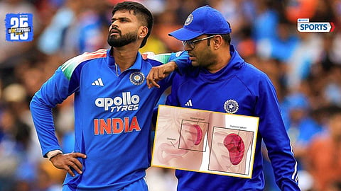 Shreyas Iyer diagnosed with spleen laceration; admitted to ICU in Sydney for observation.