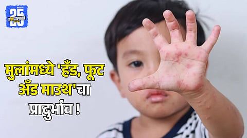 Hand, Foot, and Mouth Diseases in Children