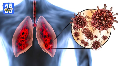 Youth lung Damage