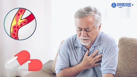 Heart disease risk
