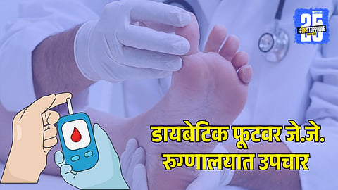 Diabetic Foot Care Now in JJ Hospital