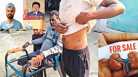 Kidney Sale Case Takes Political Turn as Doctors’ High-Profile Links Surface