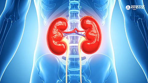 Kidney