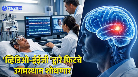 Epilepsy Detection