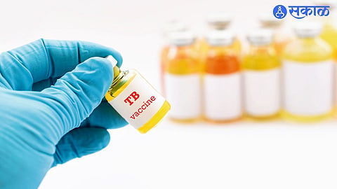 Scientists make progress toward developing an effective tuberculosis vaccine, raising hopes worldwide.