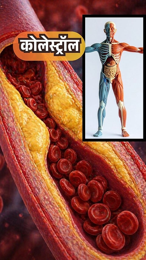 High cholesterol foods to avoid 