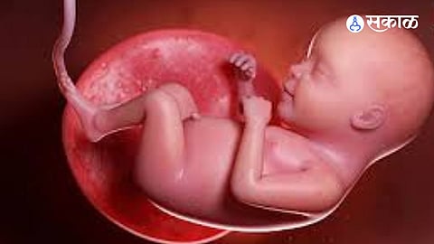 Pune Link Emerges in Foetal Sex Determination Scam; Probe Deepens