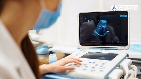 Sonography Scam