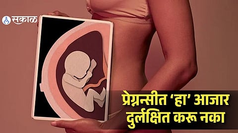 Does Crohn’s Disease Increase the Risk of Premature Delivery During Pregnancy? Experts Explain