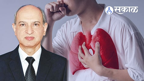 Belagavi doctor end life due to cancer pain